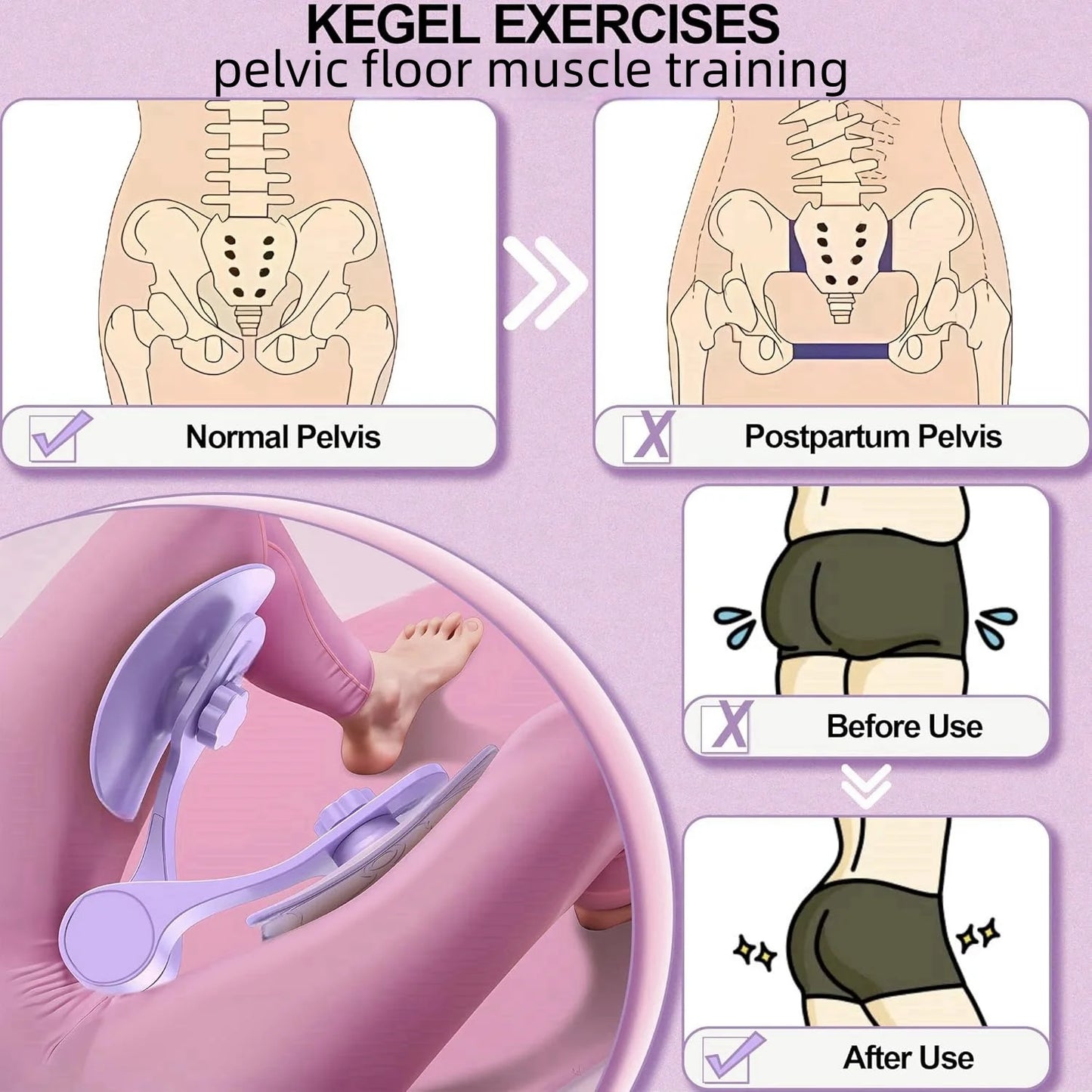 Women’s Kegel Exerciser – Pelvic Floor & Thigh Training Fitness Tool - My Willio